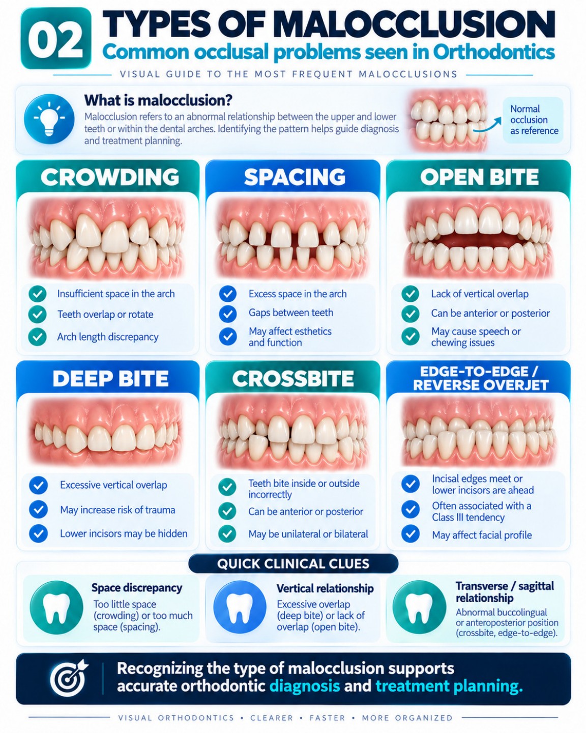 Types of Malocclusion
