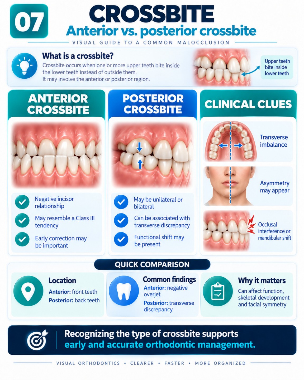 Crossbite