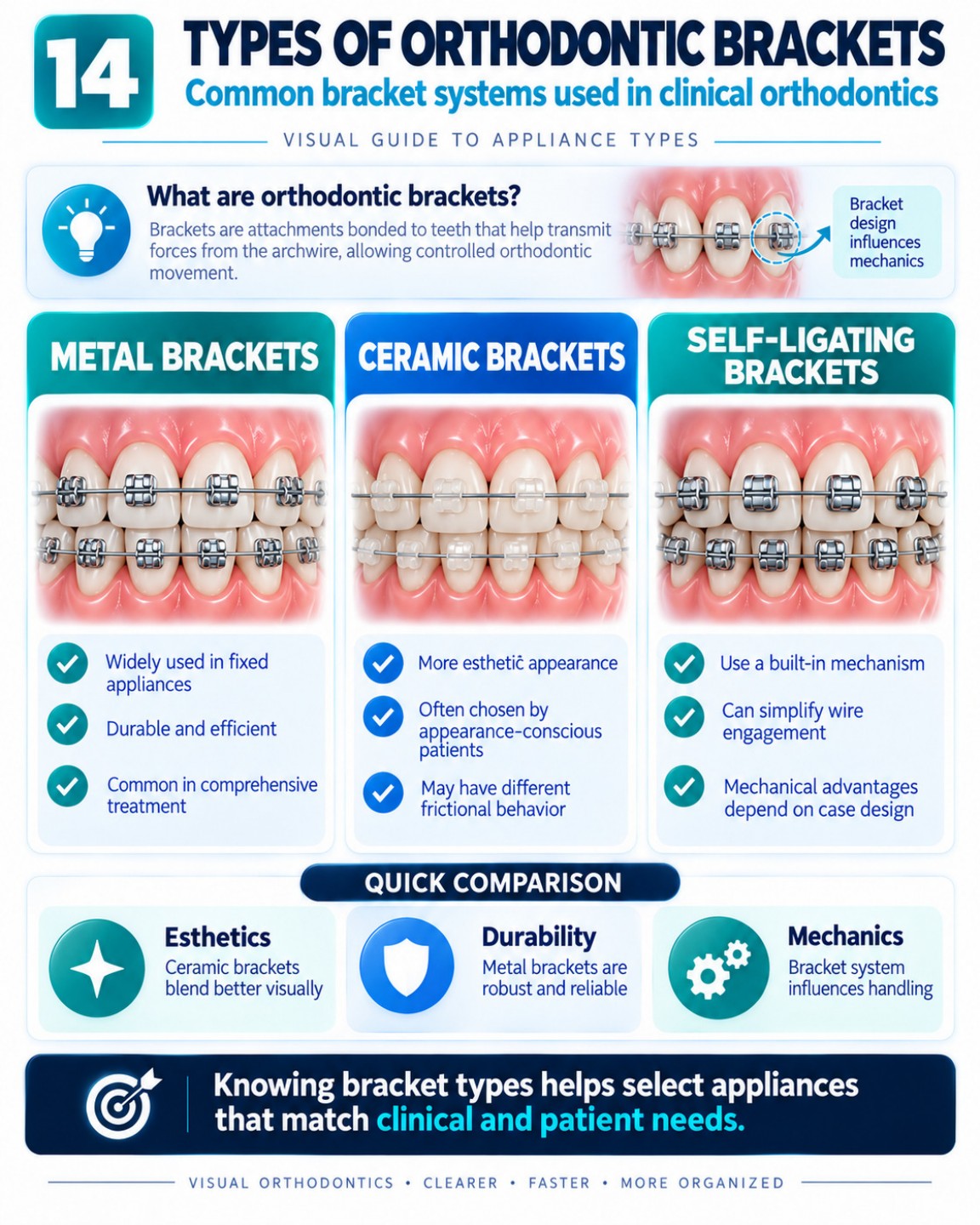 Types of Orthodontic Brackets