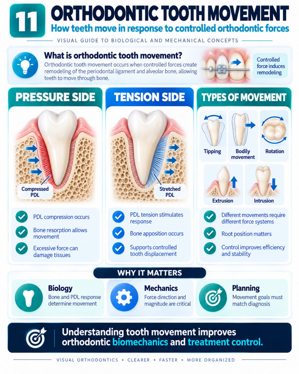 Orthodontic Tooth Movement